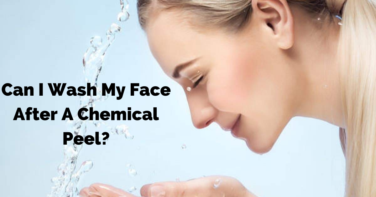 Can I wash my face after a chemical peel
